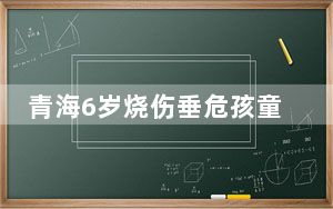 青海6岁烧伤垂危孩童千里转运 交警全程护送开辟一条绿色通道！