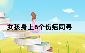 女孩身上6个伤疤同寻人启事一致 实在太幸运了 背后真相让人感到惊讶