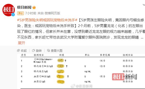 5岁男孩险失明或因玩宠物后未洗手  背后真相实在令人感到惊愕