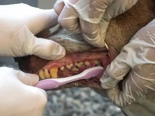 拔掉57颗牙是什么体验  背后真相实在令人感到惊愕