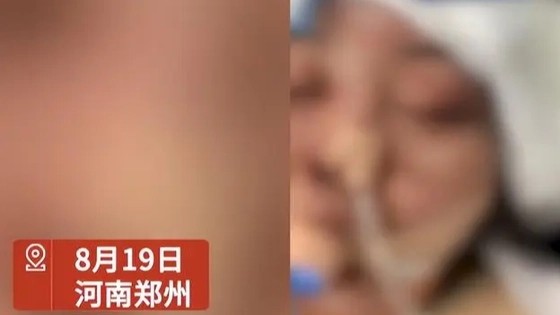 女子没给丈夫钱充手游被殴打失明 这到底是怎么回事？