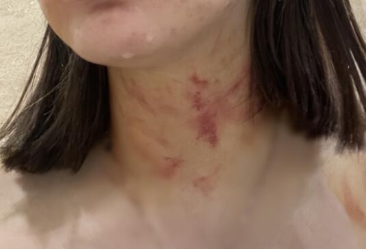 女子遭夫妻扒衣掐脖?警方介入  背后真相令人感到震惊