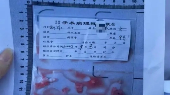 男老师疑打碎学生头骨 新证据流出 背后真相令人感到震惊